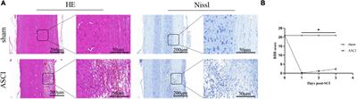 Integrated transcriptomic and metabolomic profiling reveals dysregulation of purine metabolism during the acute phase of spinal cord injury in rats